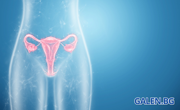 Какво представляват поликистозните яйчници (PCOS)?