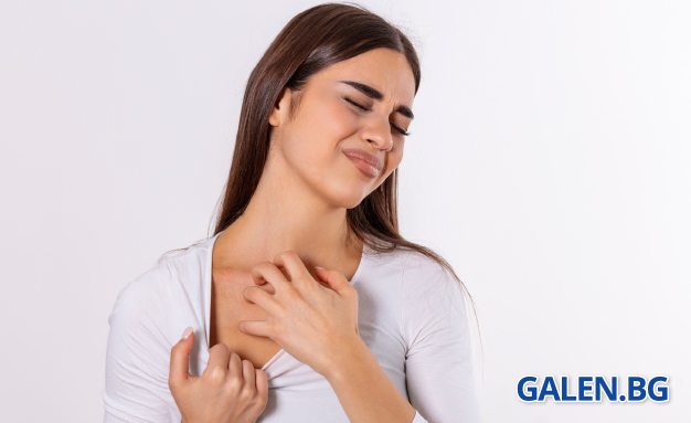 Краста: Как се предава и какво помага при лечението?
