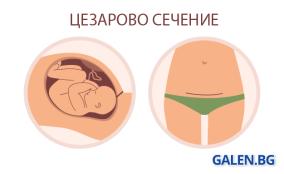 Цезарово сечение: как протича и как да се възстановим след него